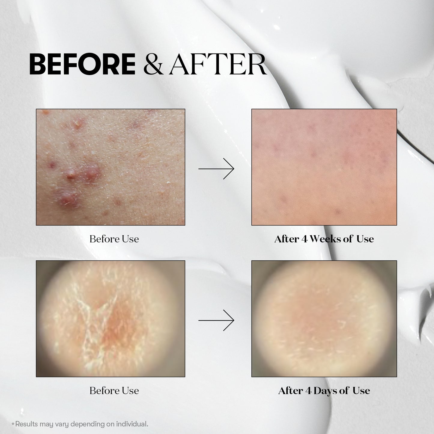 VT Reedle Shot 100 - 60ml