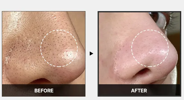 Zero Pore Exosome Shot Ampoule 7500 – Medicube 30 ml