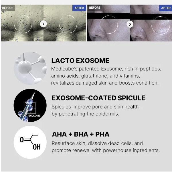 Zero Pore Exosome Shot Ampoule 7500 – Medicube 30 ml